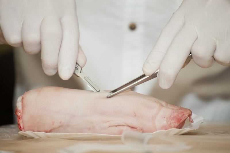 Najnowsze osiągnięcia w chirurgii